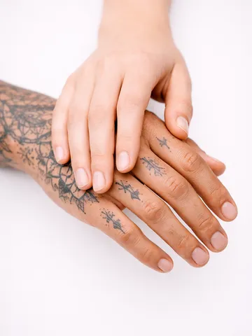 Séance de détatouage au laser sur une fleur tatouée dans le dos